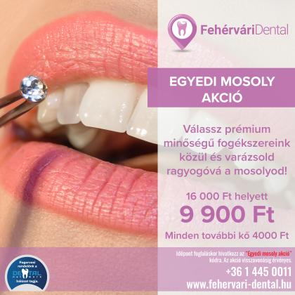 Egyedi Mosoly Akció Egyedi Mosoly Akció