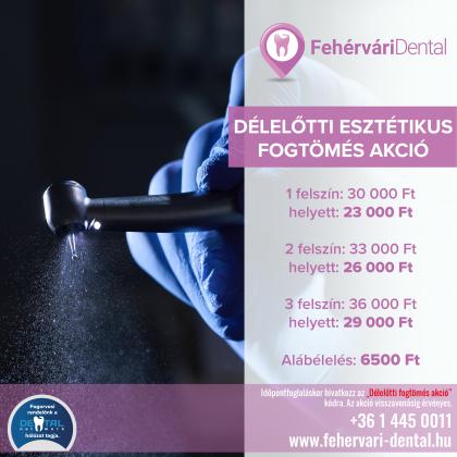 Délelőtti Esztétikus Fogtömés AKCIÓ Délelőtti Esztétikus Fogtömés AKCIÓ