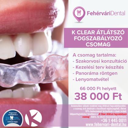 K Clear átlátszó fogszabályozó csomag K Clear átlátszó fogszabályozó csomag