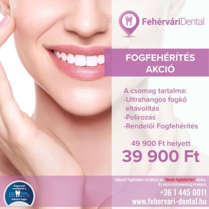 Teeth Whitening PROMOTION Teeth Whitening PROMOTION
