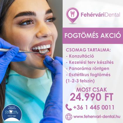 Fogtömés Akció Fogtömés Akció