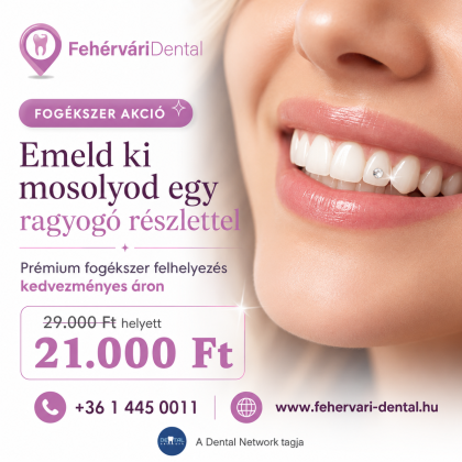 Fogékszer akció Fogékszer akció