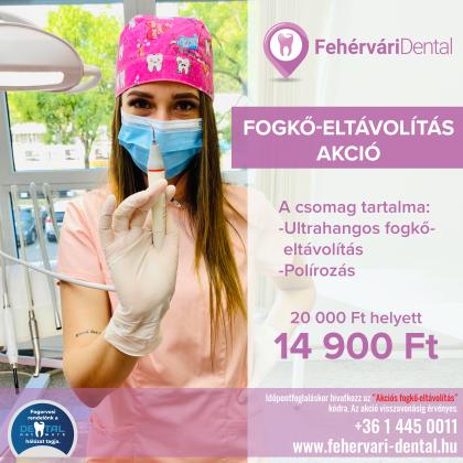 Fogkő Eltávolítás Akció Fogkő Eltávolítás Akció