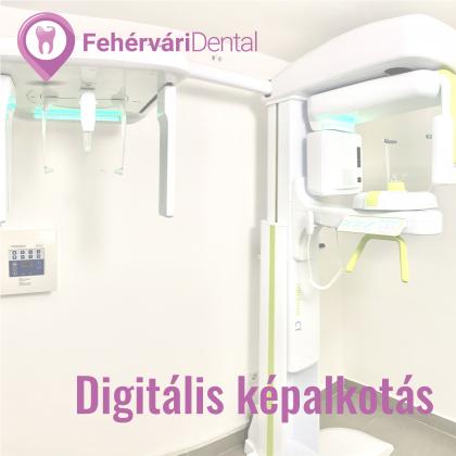 Digitális képalkotás - CT - Haifa Dent és Dentium Implant Centerben érhető el Digitális képalkotás - CT - Haifa Dent és Dentium Implant Centerben érhető el